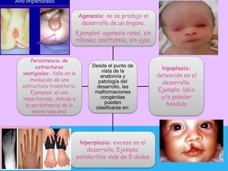 Desde el punto de
vista de la
anatomía y
patología del
desarrollo, las
malformaciones
congénitas
pueden
clasificarse en:
Agenesia: no se produjo el
desarrollo de un órgano.
Ejemplos: agenesia renal, sin
riñones; anoftalmía, sin ojos.
hipoplasia:
detención en el
desarrollo.
Ejemplo: labio
y/o paladar
hendido
hiperplasia: exceso en el
desarrollo. Ejemplo:
polidactilia: más de 5 dedos
Persistencia de
estructuras
vestigiales: falla en la
involución de una
estructura transitoria.
Ejemplos: el ano
imperforado, debido a
la persistencia de la
membrana anal
 
