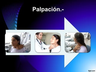 Palpación.-
Palpación.-
 