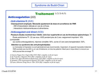 Syndrome de Budd-Chiari
Traitement 1) 2) 3) 4) 5)
Anticoagulation (2/2)
- Anti-vitamine K (AVK)
Classiquement employée. Nécessite ajustement de dose et surveillance de l'INR
. INR d'interprétation délicate en cas de cirrhose.
. Interactions médicamenteuses et alimentaires.
- Anticoagulant oral direct (AOD)
Plusieurs études montrent leur intérêt, voire leur supériorité en cas de thrombose splanchnique. 3)
Étude autrichienne 4) : 22 cas sous AOD pendant plus de 2 ans: saignement important: 18%
(comparable
aux autres anticoagulations), réponse complète: 64%, survie à 5 ans sans transplantation: 92%.
Attention au syndrome des anti-phospholipides:
Le rivaroxaban et l'apixaban ne sont généralement pas recommandés. Cependant, s'il apparaît impossible d'atteindre
l'INR souhaité avec les AVK ou en cas d'intolérance, et chez les patients n'étant pas à risque élevé, le recours aux
AOD pourrait être envisagé. 5)
1) Garcia-Pagan New Engl J Med 2023 (Réf. complète en fin de topo)
2) de Franchis J Hepatol 2022 (Réf. complète en fin de topo).
3) Wan Clin Appl Thrombosis/Hemostasis 2024 (Réf. complète en fin de topo).
4) Semmler Clin Gastroenterol Hepatol 2023 (Réf. complète en fin de topo).
5)Franco-Moreno Drug Discov Ther 2024 (Réf. complète en fin de topo).
Claude EUGÈNE 31
 