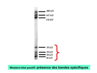 Western-blot positif: présence des bandes spécifiques
 
