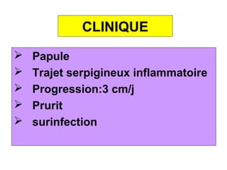 CLINIQUE
   Papule
   Trajet serpigineux inflammatoire
   Progression:3 cm/j
   Prurit
   surinfection
 