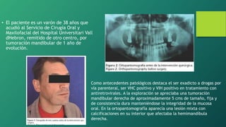• El paciente es un varón de 38 años que
acudió al Servicio de Cirugía Oral y
Maxilofacial del Hospital Universitari Vall
d’Hebron, remitido de otro centro, por
tumoración mandibular de 1 año de
evolución.
Como antecedentes patológicos destaca el ser exadicto a drogas por
vía parenteral, ser VHC positivo y VIH positivo en tratamiento con
antiretrovirales. A la exploración se apreciaba una tumoración
mandibular derecha de aproximadamente 5 cms de tamaño, fija y
de consistencia dura manteniéndose la integridad de la mucosa
oral. En la ortopantomografía aparecía una lesión mixta con
calcificaciones en su interior que afectaba la hemimandíbula
derecha.
 