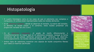 • El cuadro histológico varía en los casos de que el odontoma sea complejo o
compuesto. En ambos están representados todos los tejidos dentarios.
• En el odontoma complejo, donde se observan el esmalte, la matriz del esmalte,
la dentina, el tejido pulpar y el cemento, estos tejidos presentan una
proporción variable de uno a otro.
• En el odontoma compuesto, el grado de morfo diferenciación e
histodiferenciación es mayor que en el odontoma complejo. Aunque la forma
anatómica de las piezas dentarias presenta gran variación, se observan,
microscópicamente, los tejidos dentarios dispuestos como en el diente normal
• Ambos tipos de odontoma muestran una cápsula de tejido conjuntivo fibroso
que rodea al material calcificado.
Corte histológico
odontoma complejo.
Nótese la forma
desordenada en que se
presentan los 3 tejidos
dentarios.
“Atlas de Patologia del
Complejo Bucal”
Histopatología
 