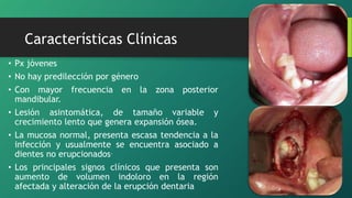 • Px jóvenes
• No hay predilección por género
• Con mayor frecuencia en la zona posterior
mandibular.
• Lesión asintomática, de tamaño variable y
crecimiento lento que genera expansión ósea.
• La mucosa normal, presenta escasa tendencia a la
infección y usualmente se encuentra asociado a
dientes no erupcionados.
• Los principales signos clínicos que presenta son
aumento de volumen indoloro en la región
afectada y alteración de la erupción dentaria
Características Clínicas
 