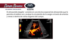 El ultrasonido doppler consiste en una técnica especial de ultrasonido que le
permite al médico ver y evaluar la circulación de la sangre a través de arterias
y venas o dentro de varios órganos del cuerpo.
 