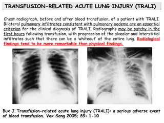 Bux J. Transfusion-related acute lung injury (TRALI): a serious adverse event
of blood transfusion. Vox Sang 2005; 89: 1-10
Chest radiograph, before and after blood transfusion, of a patient with TRALI.
Bilateral pulmonary infiltrates consistent with pulmonary oedema are an essential
criterion for the clinical diagnosis of TRALI. Radiographs may be patchy in the
first hours following transfusion, with progression of the alveolar and interstitial
infiltrates such that there can be a ‘whiteout’ of the entire lung. Radiological
findings tend to be more remarkable than physical findings.
TRANSFUSION-RELATED ACUTE LUNG INJURY (TRALI)TRANSFUSION-RELATED ACUTE LUNG INJURY (TRALI)TRANSFUSION-RELATED ACUTE LUNG INJURY (TRALI)TRANSFUSION-RELATED ACUTE LUNG INJURY (TRALI)
 