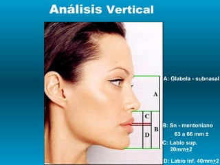 Análisis  Vertical B: Sn - mentoniano 63 a 66 mm   ± A: Glabela - subnasal C: Labio sup. 20mm + 2 D: Labio inf. 40mm + 2 