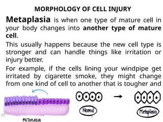 MORPHOLOGY OF CELL INJURY
Metaplasia is when one type of mature cell in
your body changes into another type of mature
cell.
This usually happens because the new cell type is
stronger and can handle things like irritation or
injury better.
For example, if the cells lining your windpipe get
irritated by cigarette smoke, they might change
from one kind of cell to another that is tougher and
protects better.
The good news is, this change can go back to
normal if the irritation or stress stops.
 