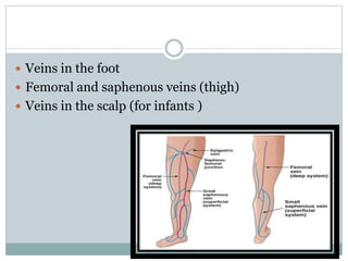  Veins in the foot
 Femoral and saphenous veins (thigh)
 Veins in the scalp (for infants )
 