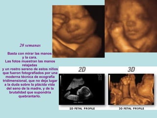 20 semanas Basta con mirar las manos  y la cara.  Las fotos muestran las manos relajadas  y un rostro sereno de estos niños que fueron fotografiados por una moderna técnica de ecografía tridimensional, que no deja lugar a la duda sobre la plácida vida  del seno de la madre, y de la brutalidad que supondría quebrantarlo.  