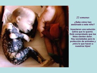 22 semanas ¿Sabe cómo han asesinado a este niño? Inyectaron una solución salina que lo quemó.  Está comprobado que los fetos sienten dolor.  Hay sociedades para la protección de animales y ¡mira lo que hacen a nuestros hijos! 