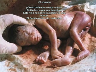 24 semanas ¿Quién defiende a estos niños?  ¿Quién lucha por sus derechos?  Este niño no sonreirá a nadie en este mundo.  24 Semanas de vida, nada más. 