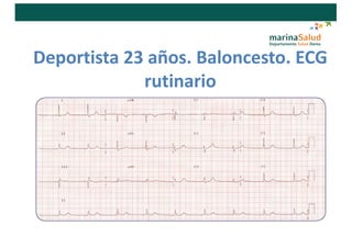 Deportista 23 años. Baloncesto. ECG
rutinario
 