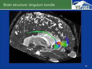 Brain structure: singulum bundle




                                   21
 